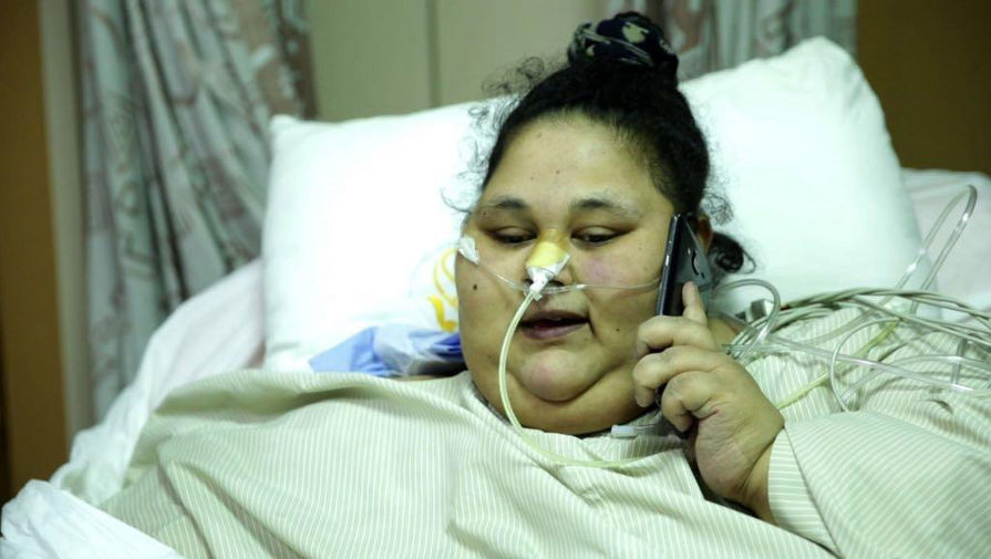 Самая полная в мире женщина после операции похудела на 140 кг